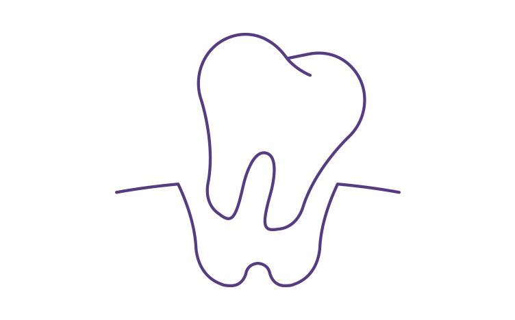 tooth-loss-752x468.png