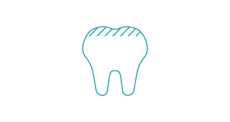 14903-6 Apr-ToothLife-752x400_ToothStain.png