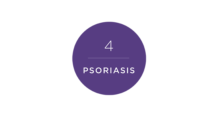 psoriasis-752x400.png