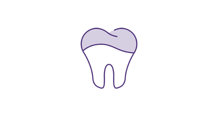 dental-sealant-icon-752x400.webp