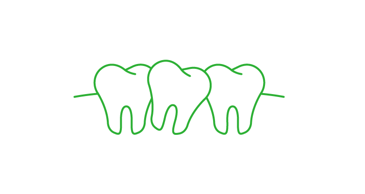 crowded-teeth-icon-752x400.webp